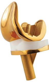 Ouro excel mpk